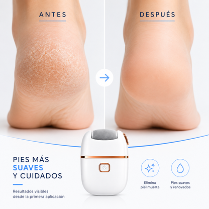 Lima Eléctrica para Callos y Talones Agrietados